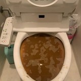 国内大腸がん、5割が細菌原因か　毒素で変異、若年発症増に関係も